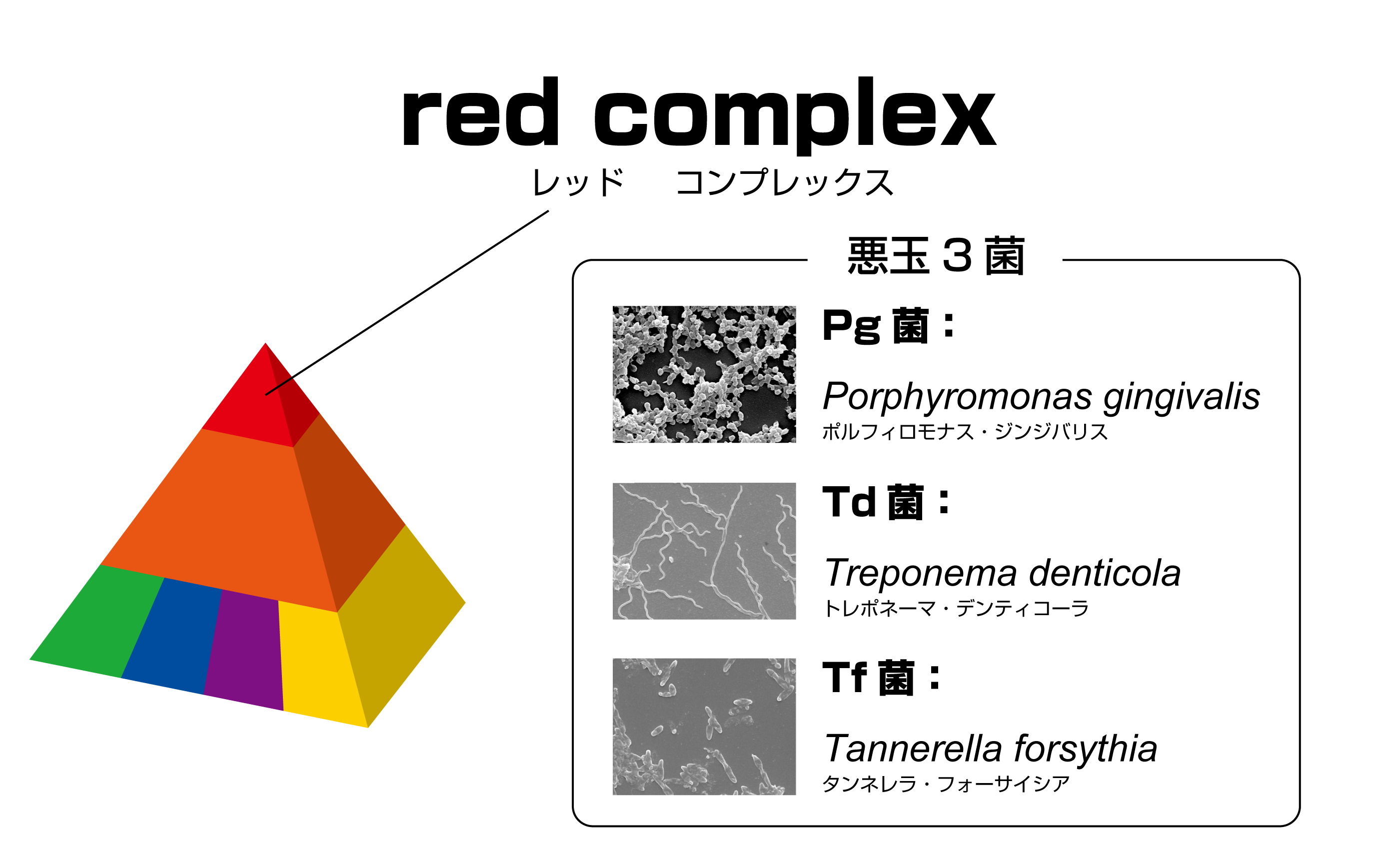 red complex ピラミッド